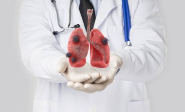 Ciğerlerinde COVID 19 enfeksiyonu olan bir doktor.