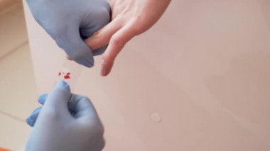 Blood Test Nurse Taking Blood From Young Girls Finger Puting It On Glass HIV