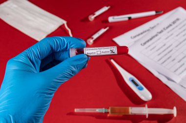 COVID-19 testi için kan örneğiyle test tüpü