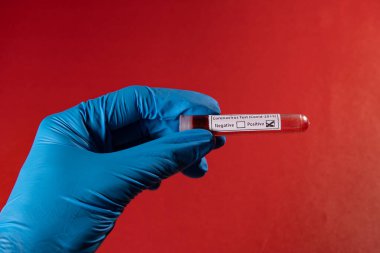 COVID-19 testi için kan örneğiyle test tüpü