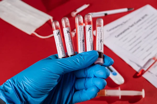 COVID-19 testi için kan örneğiyle test tüpü
