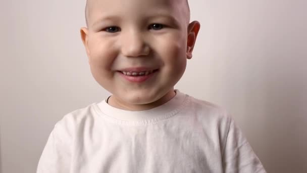 Primer plano de dientes de niño. Salud, higiene dental, problemas dentales, caries — Vídeo de stock