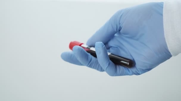 El médico que usa guantes sostiene el tubo con la muestra, análisis de sangre. Diagnóstico COVID-19 — Vídeo de stock