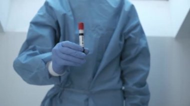 mikrobiyolog, mavi eldivenli tıbbi görevli kan testi sonuçlarını gösteriyor.