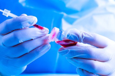 Laboratuvarda kan örneğiyle çalışan bir kadın, mavi arka planda yakın plan, Virüs Fikri