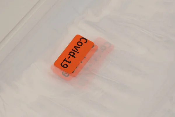 Pcr Coronavirus Tests Комплекти Аварійному Місці Університетській Лікарні Льєж Бельгія — стокове фото