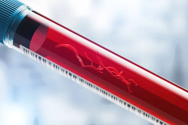 Ncov coronavirus dentro del tubo de análisis de sangre — Foto de Stock