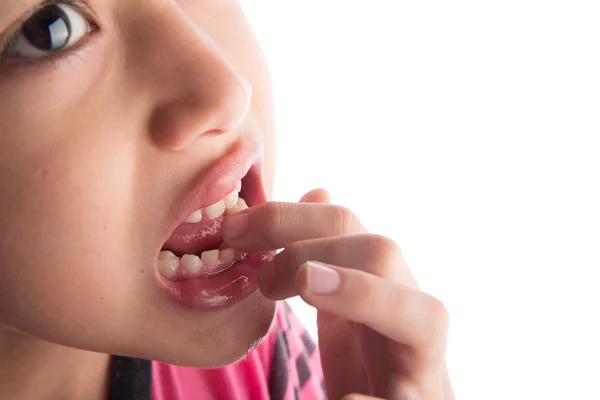 Menino com os primeiros novos dentes permanentes — Fotografia de Stock