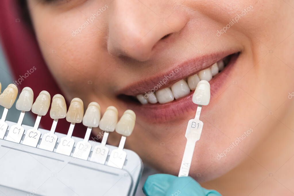 dentist using shade guide at beautiful smile of woman mouth to check the process of teeth whitening or shades of the implants close-up. dental health and teeth care concept