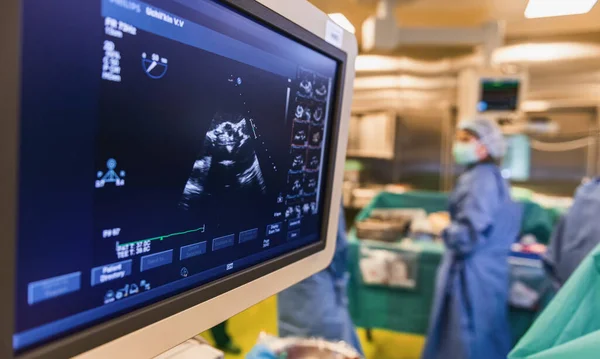 Szívultrahang Monitorozás Műtét Közben Műtőben — Stock Fotó