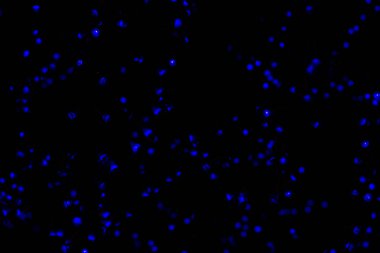 Bokeh mavisi bulanık ışıklar soyut renk.