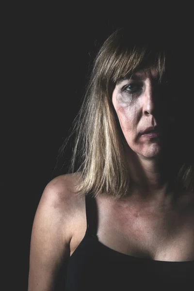 Érzelmi Portré Bántalmazott Nőről Sírás Fájdalom Családon Belüli Erőszak Fogalma Stock Fotó
