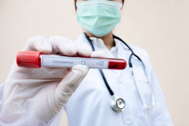 Doktor eli kan tüpü tutuyor ve kan testinin sonuçlarını kaydediyor..