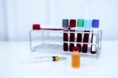 Sarı serum tüpü ve beyaz zemin üzerinde test edilen koronavirüs tüpü resmi..