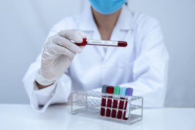 Doktorun elinde beyaz arka planda kan tüpü koronavirüsü testi olan bir resim..