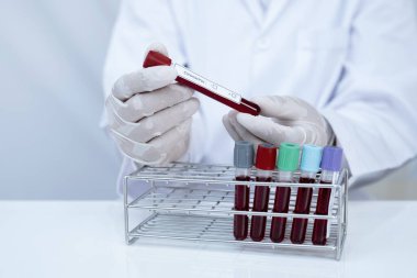 Doktorun elinde beyaz arka planda kan tüpü koronavirüsü testi olan bir resim..