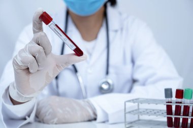 Doktor eli kan tüpü tutuyor ve kan testinin sonuçlarını kaydediyor..