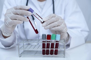 Doktor eli kan tüpü tutuyor ve kan testinin sonuçlarını kaydediyor..