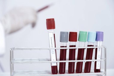 Kan tüpü ve doktorun elinde beyaz arka planda şırınga resmi..