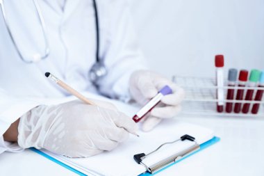 Doktor eli kan tüpü tutuyor ve kan testinin sonuçlarını kaydediyor..
