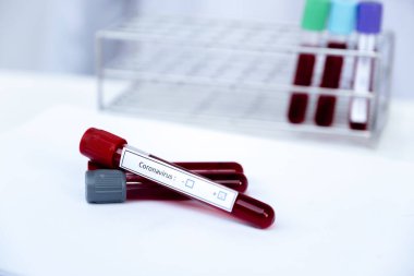 Beyaz zemin üzerinde Coronavirus testi yapılan kan tüpü resmi..
