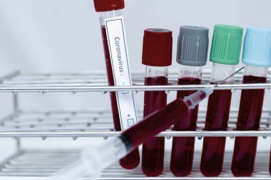 Beyaz arka planda Coronavirus test ve şırınga kan tüpü resmi.