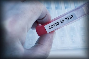 Koruyucu eldivendeki bir el üzerinde kırmızı sıvıyla etiketlenmiş bir test tüpünü temiz tıbbi tüplerin arka planında tutuyor. Coronavirüs enfeksiyonunun yayılması sorunu