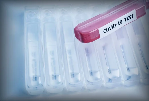Test tüpünde COVID 19 etiketi ve temiz tıbbi tüplerin arka planında kan testi var. Coronavirüs enfeksiyonunun yayılması sorunu