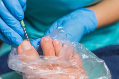 Pedikür süreci, manikür kaldırma