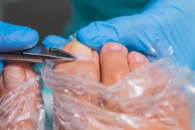 Pedikür süreci, manikür kaldırma