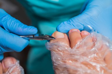 Pedikür süreci, manikür kaldırma