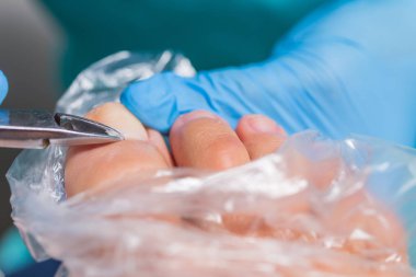 Pedikür süreci, manikür kaldırma