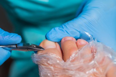 Pedikür süreci, manikür kaldırma