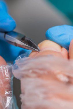 Pedikür süreci, manikür kaldırma