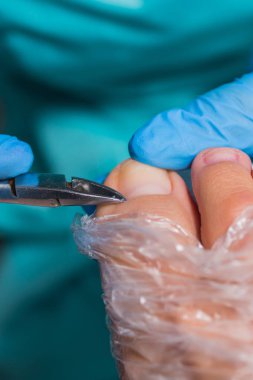 Pedikür süreci, manikür kaldırma