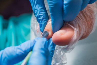 Pedikür portre. kütikül kaldırma