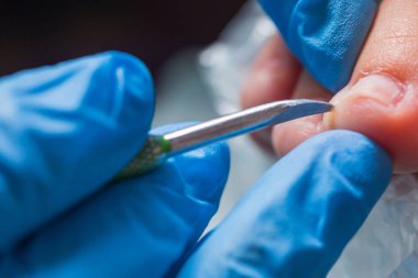 Pedikür portre. kütikül kaldırma