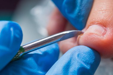 Pedikür portre. kütikül kaldırma