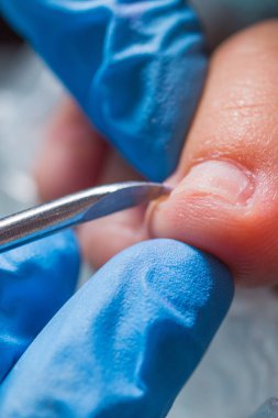 Pedikür portre. kütikül kaldırma