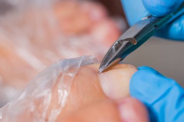 Pedikür portre. kütikül kaldırma