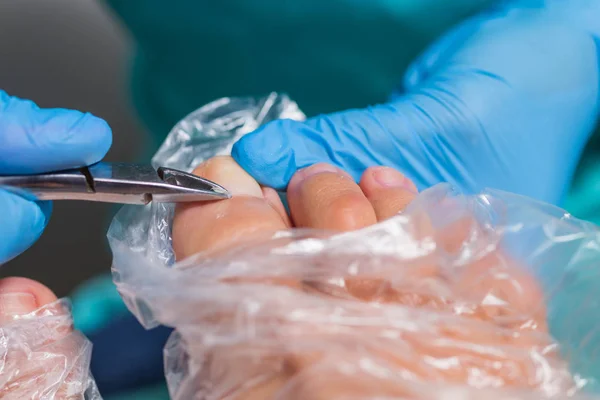 Pedicure process, cuticle removal — Stock Photo, Image