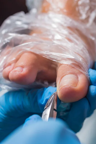 Pedicure closeup. cuticle removal — Stock Photo, Image