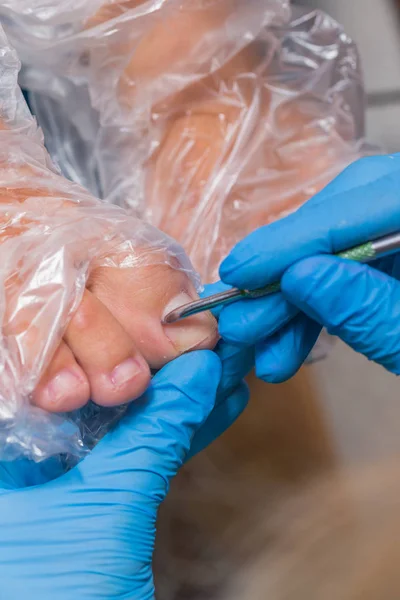 Pedicura de cerca. eliminación de cutículas — Foto de Stock