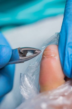 Resmi bir pedikür işlemi için