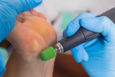 Resmi bir pedikür işlemi için