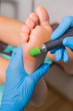 Pedikür portre. kütikül kaldırma