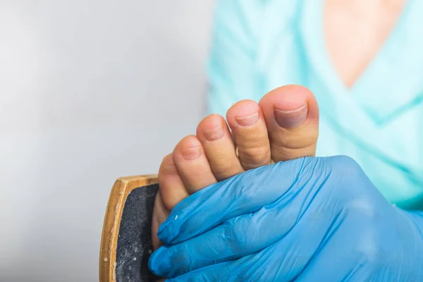 Peeling durante una pedicure — Foto Stock