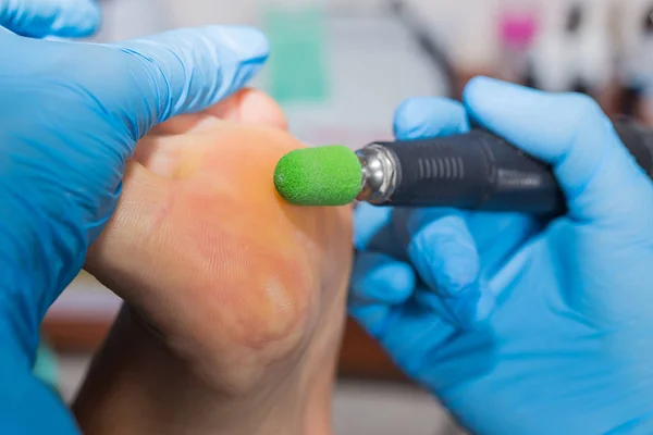 Pedicure closeup. cuticle removal — Stock Photo, Image