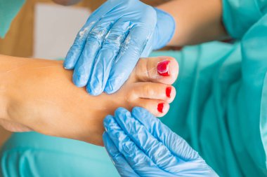 Pedikür sırasında peeling