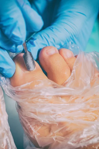 Descascamento durante uma pedicura — Fotografia de Stock